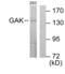 Cyclin G Associated Kinase antibody, abx013281, Abbexa, Western Blot image 