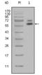 Keratin 5 antibody, NBP1-47432, Novus Biologicals, Western Blot image 