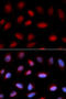 Serpin Family A Member 6 antibody, STJ28367, St John