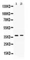 TNF Receptor Superfamily Member 14 antibody, PA5-80149, Invitrogen Antibodies, Western Blot image 