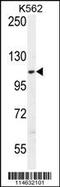 Alanyl-TRNA Synthetase 2, Mitochondrial antibody, 62-990, ProSci, Western Blot image 