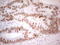 RB Transcriptional Corepressor 1 antibody, LS-C339687, Lifespan Biosciences, Immunohistochemistry paraffin image 