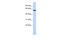 EYA Transcriptional Coactivator And Phosphatase 1 antibody, 25-067, ProSci, Immunohistochemistry frozen image 