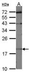 Ubiquitin-conjugating enzyme E2 C antibody, NBP2-20782, Novus Biologicals, Western Blot image 