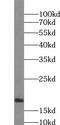 Ubiquitously Expressed Prefoldin Like Chaperone antibody, FNab09353, FineTest, Western Blot image 