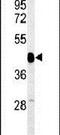 Small Glutamine Rich Tetratricopeptide Repeat Containing Beta antibody, PA5-24998, Invitrogen Antibodies, Western Blot image 