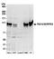 Novel retinal pigment epithelial cell protein antibody, A304-853A, Bethyl Labs, Western Blot image 