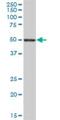 Lipase H antibody, H00200879-B01P, Novus Biologicals, Western Blot image 