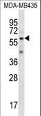 Fascin Actin-Bundling Protein 3 antibody, LS-C166256, Lifespan Biosciences, Western Blot image 