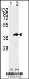 Lymphokine-activated killer T-cell-originated protein kinase antibody, TA302075, Origene, Western Blot image 