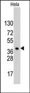 Heparin Binding Growth Factor antibody, AP13464PU-N, Origene, Western Blot image 