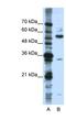 KH RNA Binding Domain Containing, Signal Transduction Associated 3 antibody, NBP1-57104, Novus Biologicals, Western Blot image 