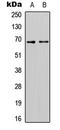 Solute Carrier Family 7 Member 4 antibody, LS-C358862, Lifespan Biosciences, Western Blot image 