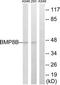 Bone Morphogenetic Protein 8b antibody, TA313512, Origene, Western Blot image 