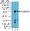 SAM And HD Domain Containing Deoxynucleoside Triphosphate Triphosphohydrolase 1 antibody, NBP2-27097, Novus Biologicals, Western Blot image 