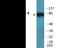 Protein Kinase C Theta antibody, EKC2495, Boster Biological Technology, Western Blot image 