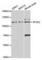 AP-2 complex subunit alpha-2 antibody, abx004129, Abbexa, Western Blot image 