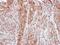 Ferritin Light Chain antibody, GTX101211, GeneTex, Immunohistochemistry paraffin image 