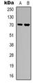 Ribosomal Protein S6 Kinase B1 antibody, orb318772, Biorbyt, Western Blot image 