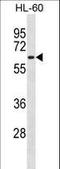 Dual specificity protein kinase CLK2 antibody, LS-C168844, Lifespan Biosciences, Western Blot image 