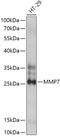 Matrix Metallopeptidase 7 antibody, 13-253, ProSci, Western Blot image 