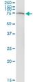 Solute Carrier Family 22 Member 12 antibody, H00116085-M02, Novus Biologicals, Western Blot image 