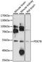 Phosphodiesterase 7B antibody, LS-C747313, Lifespan Biosciences, Western Blot image 