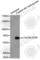 Cell Division Cycle 25B antibody, AP0322, ABclonal Technology, Western Blot image 