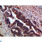 Catenin Delta 1 antibody, LS-C814221, Lifespan Biosciences, Western Blot image 