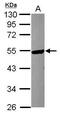 Katanin Catalytic Subunit A1 antibody, GTX119548, GeneTex, Western Blot image 