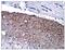 Calbindin 2 antibody, GTX14689, GeneTex, Immunohistochemistry paraffin image 
