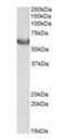 Solute Carrier Family 22 Member 3 antibody, orb125242, Biorbyt, Western Blot image 