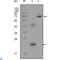 Insulin Like Growth Factor Binding Protein 2 antibody, LS-C812835, Lifespan Biosciences, Western Blot image 