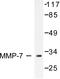 Matrix Metallopeptidase 7 antibody, LS-C176130, Lifespan Biosciences, Western Blot image 