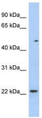 Transcription Elongation Factor A Like 3 antibody, TA339775, Origene, Western Blot image 