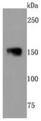 Neurofilament Medium antibody, A06821, Boster Biological Technology, Western Blot image 