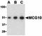 Poly(RC) Binding Protein 4 antibody, orb74452, Biorbyt, Western Blot image 