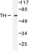 Tyrosine Hydroxylase antibody, AP06420PU-N, Origene, Western Blot image 