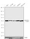 ADAM Metallopeptidase With Thrombospondin Type 1 Motif 1 antibody, 720329, Invitrogen Antibodies, Western Blot image 