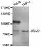 Interleukin 1 Receptor Associated Kinase 1 antibody, MBS126078, MyBioSource, Western Blot image 