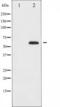 Forkhead Box O4 antibody, TA325481, Origene, Western Blot image 