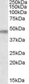Target Of Myb1 Like 1 Membrane Trafficking Protein antibody, TA303340, Origene, Western Blot image 