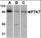 Protein Tyrosine Kinase 7 (Inactive) antibody, orb88372, Biorbyt, Western Blot image 