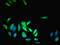 LRR Binding FLII Interacting Protein 1 antibody, LS-B12322, Lifespan Biosciences, Immunofluorescence image 