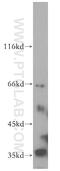 SRP Receptor Subunit Alpha antibody, 12090-1-AP, Proteintech Group, Western Blot image 