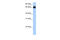 Zinc Finger Protein 433 antibody, 26-535, ProSci, Enzyme Linked Immunosorbent Assay image 