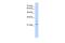 Ovo Like Transcriptional Repressor 1 antibody, PA5-41480, Invitrogen Antibodies, Western Blot image 