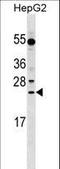 Leucine Rich Repeat Containing 29 antibody, LS-C158072, Lifespan Biosciences, Western Blot image 