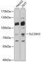Solute Carrier Family 28 Member 3 antibody, 13-579, ProSci, Western Blot image 