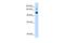 GTPase Activating Protein And VPS9 Domains 1 antibody, GTX47022, GeneTex, Western Blot image 